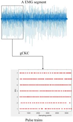 A Bi-GRU-attention neural network to identify motor units from high-density surface electromyographic signals in real time